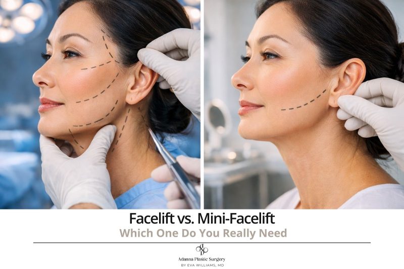 Facelift vs. Mini-Facelift: Which One Do You Really Need?